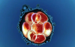 试管取卵后尿酸升高竟是真的？原来是这几个因素在“捣鬼”！