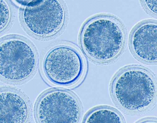 试管养囊有三大合格标准，每一样都不可缺少！