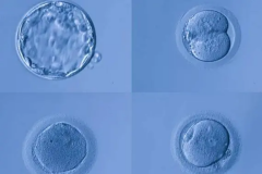 拮抗剂方案适合鲜胚还是冻胚？听听专家怎么说的