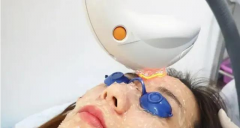 试管移植前三月能否做光子嫩肤？看这里，其实危害没那么大！