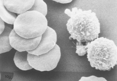 白细胞多了对移植有没有影响？身体不对劲得小心