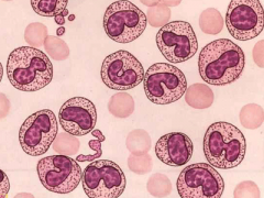 移植2个鲜胚很常见，想做试管这些得知道！