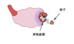 卵泡不成形严重吗？会不会影响怀孕？
