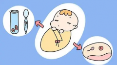 什么是试管二步移植法？费用贵吗？