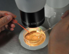 试管单腔取卵适合哪些人做？安全性怎么样？