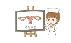 弓形子宫做试管生双胞胎要满足哪些条件？子宫环境调理是核心！