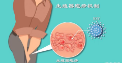 生殖疱疹不一定会影响试管婴儿手术，不需要过度担心
