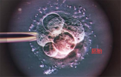 试管科普，试管LEPPOS是什么意思？