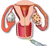 泰国试管就医全攻略，轻松开启泰国试管宝宝之旅