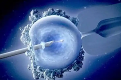 全面解析泰国试管预算：一步步了解从准备到成功的所有花销细节