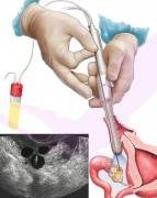 成都最好的试管医院是哪家？成都顶尖试管医院排名更新！