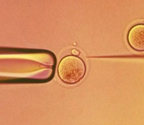 做试管前必看！2025年进行第三代试管技术，费用大概需要多少？全面解