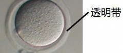 卵子透明带不正常怎么办？如何提高试管婴儿成功率？