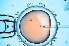 广西三代试管费用盘点，要少花钱一定要做到这几点！