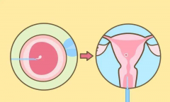 鲜胚移植后，吃香菜会不会导致子宫收缩，影响移植效果呢？全面解析