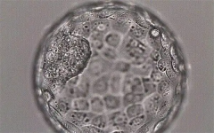 试管早期胚胎分裂很慢是为什么？需要去医院检查吗？