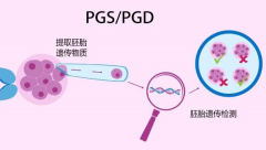 第一代试管包生'男'孩费用与条件：如何选择最适合的方案？