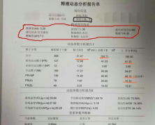 一分钟教你读懂精液检查报告单，判断精液质量不再难