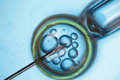 胚胎移植的几种常见并发症，手术前你可要了解清楚！