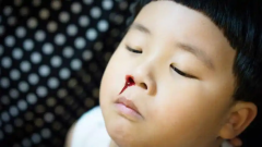 孩子经常流鼻血是为什么？常见原因有以下几种