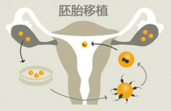 试管移植成功的秘密：听听成功妈妈们的亲身经历！