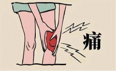 女性膝盖疼痛可能暗示哪些健康问题？全面解析膝盖疼痛的常见病因与应对策略