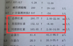 胆红素高引发四大危害，有问题一定要及时去医院检查！