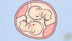 株洲妇幼保健院试管生双胞胎费用全揭秘！