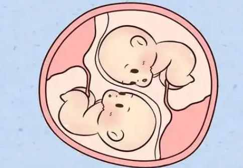 试管做双胞胎费用
