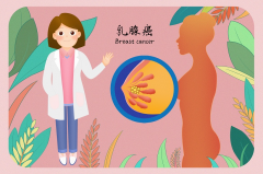 乳腺癌早期有什么症状？全面解析助您早预防！