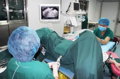 试管取卵要不要剖腹？告诉你真实情况！
