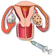 山西煤炭医院生殖中心的表现如何？全面深入了解其医疗技术、服务质