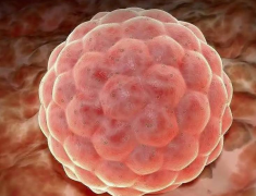 盘点试管移植后出血的常见原因，哪些现象可能是着床失败？