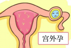 试管移植会产生宫外孕吗？如何预防宫外孕？