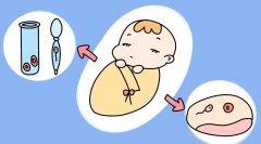 为何三代试管婴儿也无法避免胎停？专家详解原因！