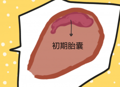 胚胎移植后什么时候能看到孕囊？专家为你答疑