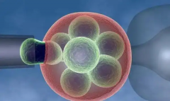 子宫动脉血流sd正常值范围科普，试管移植前一定要达到标准才行！