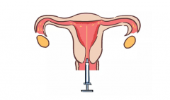 囊胚移植后的第八天，如果发现基础体温有所下降，这究竟是怎么一回