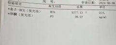 移植囊胚要注意观察hcg值，看看多少才正常？