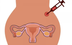 浙大二院一代试管技术费用详解：全面了解做一次试管需要多少钱