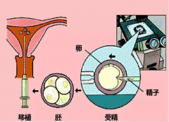 试管过程中，男性的精子是如何被采集出来的？详细步骤与注意事项