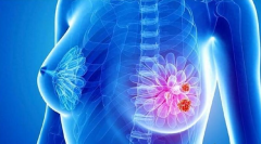 患上乳腺癌了还能生孩子吗？三种方法可以保存女性生育能力！