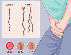 什么是畸形精子症？可以做试管助孕吗？