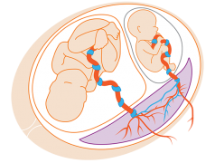 贵阳市第二人民医院进行第一代试管治疗，整个过程的费用大概需要多