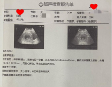 什么是子宫内膜容受性？怎么看懂检查报告？
