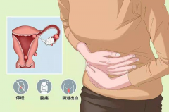 什么是盆腔积液？对试管移植有什么影响？
