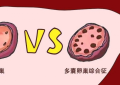 多囊卵巢综合征助孕选择哪种方案？人工授精和试管对比！