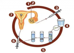 进行第一代试管技术生育男孩大概需要多少费用？