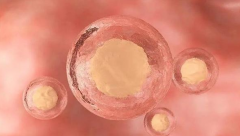 黄体期促排知识：哪些人适合选择黄体期促排卵方案？