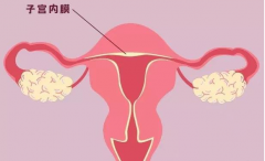 盘点子宫内膜需要做的检查，附检查费用！